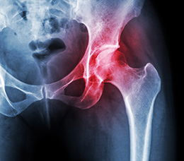 Duke Perspectives From the American Academy of Orthopaedic Surgeons 2020 Annual Meeting