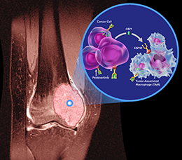 A New Era in TGCT Treatment: Novel Targeted Therapies and Their Effect on Shared Decision Making