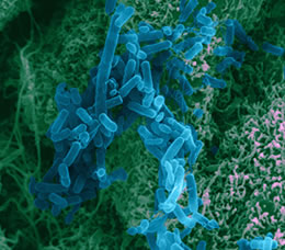 Use It, Lose It, or Something in Between? Expert Perspectives on the Utility of Antibiotic Susceptibility Testing in Cystic Fibrosis Treatment Planning