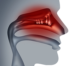 Deconstructing Barriers in Support of the Systemic Management of Chronic Rhinosinusitis With Nasal Polyps