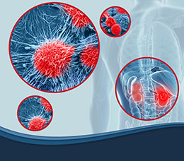 Integrating Advances and Optimizing Contemporary Strategies in Renal Cell Carcinoma