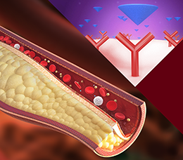 <em>Decision-IQ:</em> When Is PCSK9 Inhibitor Therapy Beneficial?
